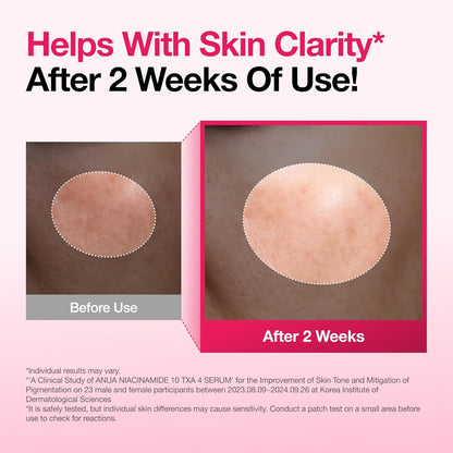 10% Niacinamide + 4% TXA Skin Clarifying & Glow Serum (30ml)